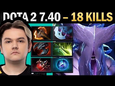 Faceless Void Pro Carry with Battlefury and 18 Kills - Gameplay Dota