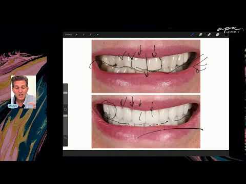 LIVE Case Review in LA