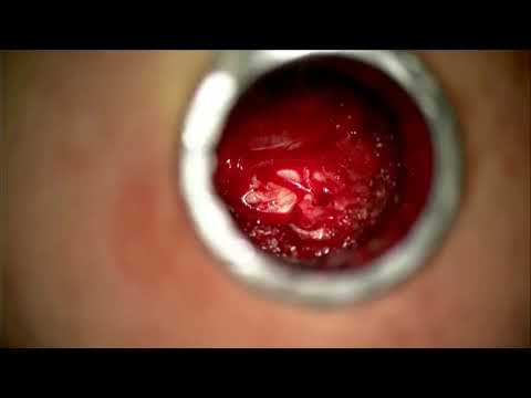 Luis Alberto Ibarra Zazueta-13