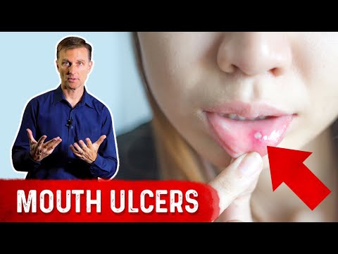 Forget the Coffee Do Wheat Grass Juice for ENERGY