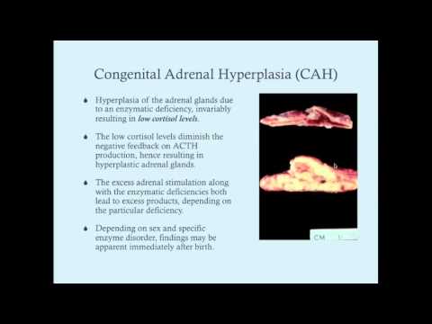 Biochemistry of Congenital Adrenal Hyperplasia - CRASH! Medical Review Series