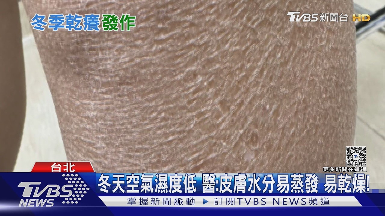 影音/天冷乾燥皮膚狂癢?醫揭冬季癢、冬季濕疹 好發部位與3招止癢!