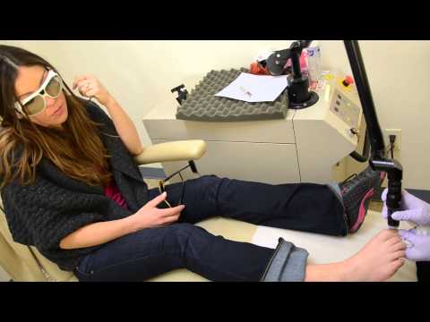 Paa halamang-singaw paggamot na may hydrogen peroxide at suka Mga review paghahanda Lotseril
