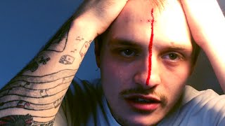 Staple Gun Roulette (WARNING: BLOOD)