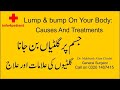 Jism Par Giltian Lump Bump On Your Body جسم پر گلٹیاں بن جانا Doctor Mahboob Alam C