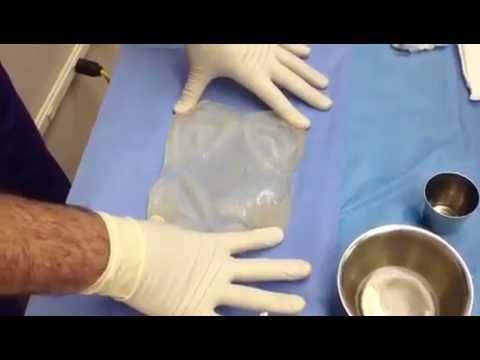 Breast augmentation video thumbnail