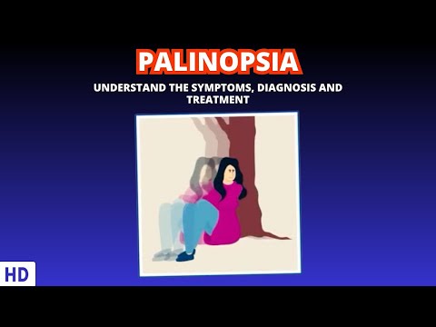 Effects of Cannabis on your body