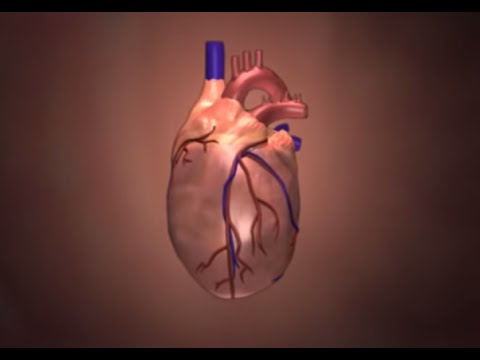 Kawasaki Disease: Animated Heart Video