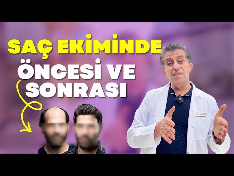 Sosyal Medyadaki Saç Ekim Sonuçları Gerçeği Yansıtıyor mu? I Dr. Hamid AYDIN
