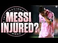 Lionel Messi EXITS In 1st Half With DISCOMFORT In Leg, Inter Miami DOMINATES Toronto FC I CBS Sports