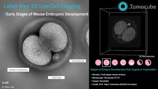 Mouse Embryonic Development | 3D Timelapse with Tomocube Holotomography (HT-X1)