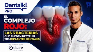El complejo rojo: las 3 bacterias que pueden destruir tus implantes dentales