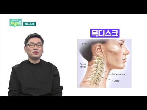2021/12/10 TV닥터처방전 – 현대인의 고질병 목디스크