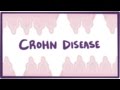 Crohn S Disease Crohn Disease Causes Symptoms Pathology
