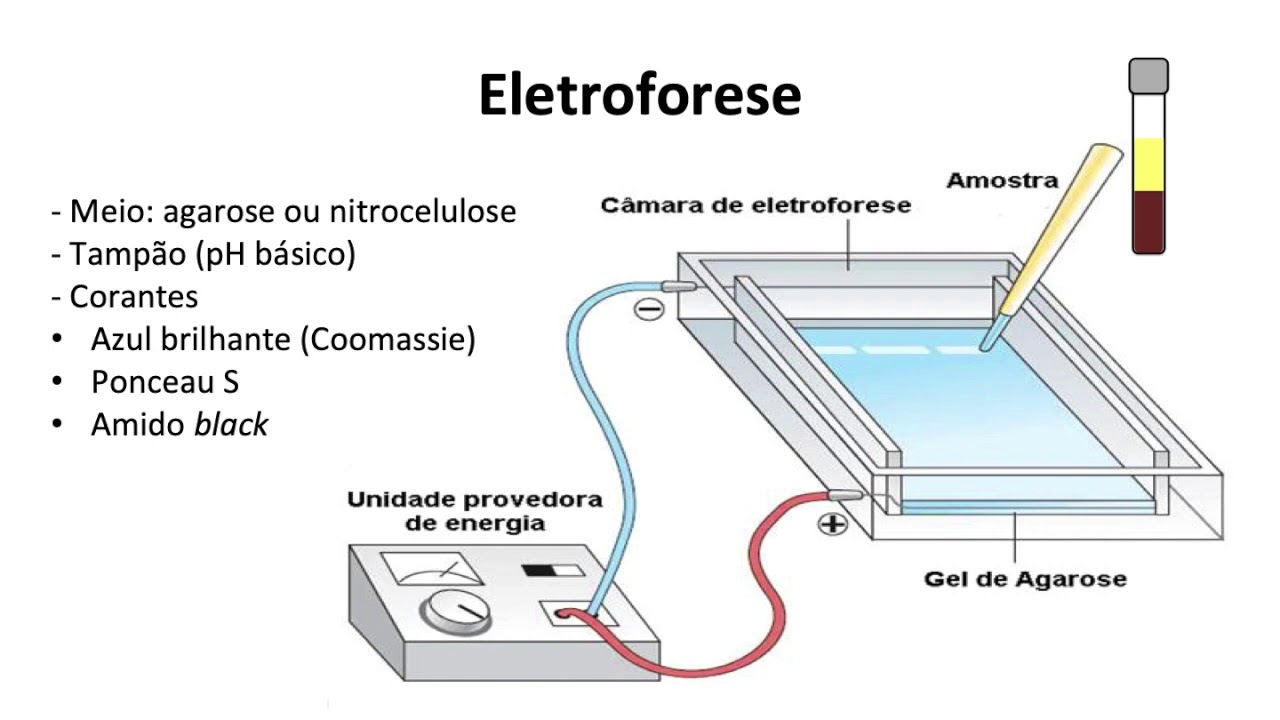 S05_V01 - Avaliação laboratorial de proteínas plasmáticas