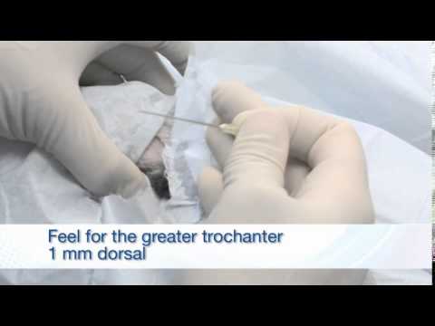 C-PET Procedure - Part 3, Intra Articular Injection