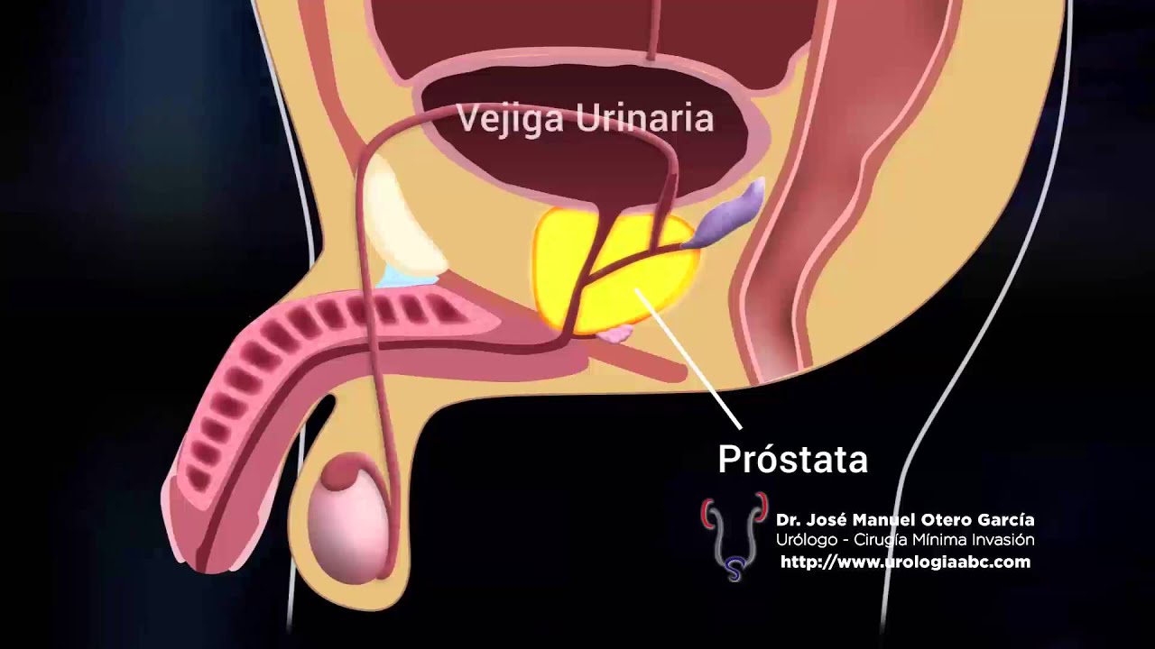 José Manuel Otero García-30
