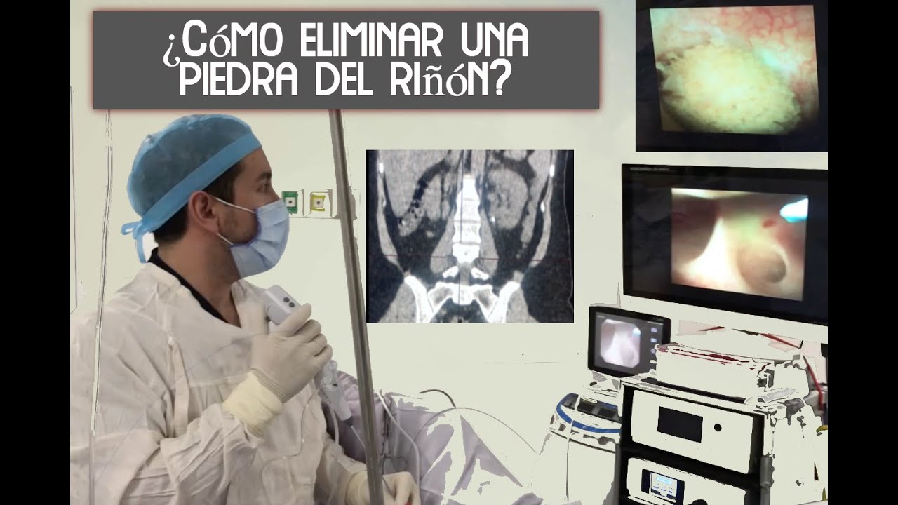 Bruno Rubí López-15