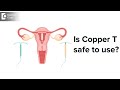 Is Copper T Safe To Use Benefits Side Effects And Procedure Dr H S Chandrika Doctors Circle