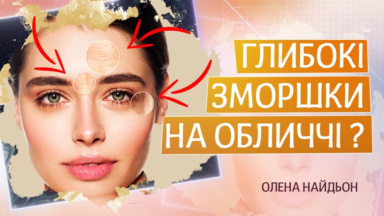 Как разглаживает и заполняет морщины Belotero?