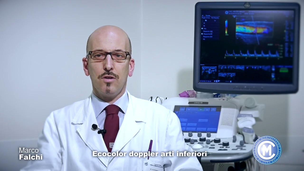 Watch Now Marco Falchi - Ecocolor doppler arti inferiori Marco Falchi - Ecocolor doppler arti inferiori