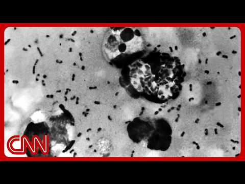 Ex-Covid czar: Potential Russia plague case raises ‘red flags’