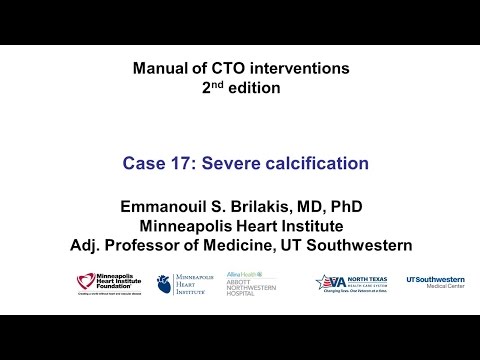 Case 17: Manual of CTO Interventions - Perforation of heavily calcified CTO