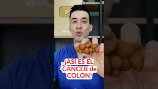 Download lagu Your POOP SCREAMS COLON CANCER! mp3