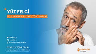 Yüz Felci - Uygulanan Fizik Tedavi Yöntemleri