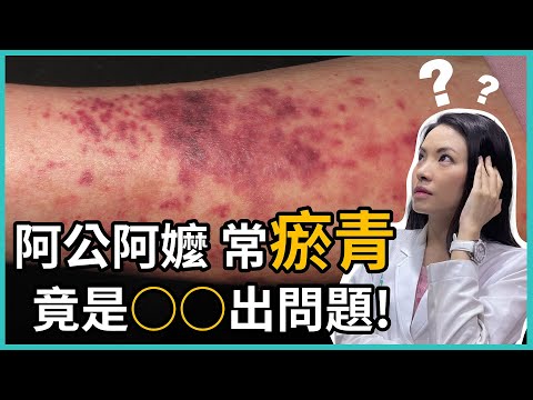 瘀青 長毛