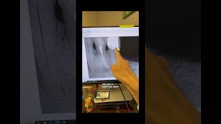 A cbct only ads value if you know how to use it! #dentists #rootcanaltherapy #dentalcare #dentistry