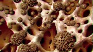 Download lagu Cancer Cells vs. Healthy Cells mp3 Download lagu Cancer Cells vs. Healthy Cells mp3