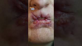 ضحية لممارسات التجميل