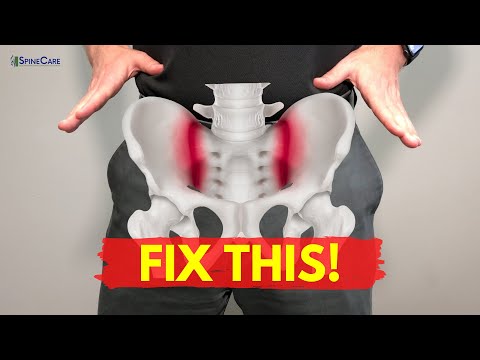 How to Fix Sacroiliac Joint Pain for Good