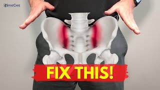 How to Fix Sacroiliac Joint Pain for Good