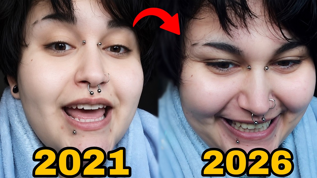 FINALMENTE HA RISPOSTO, DOPO 5 ANNI!