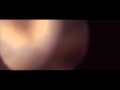 The American Dollar - Twelve Days Awake vs M83 - Last Saturday