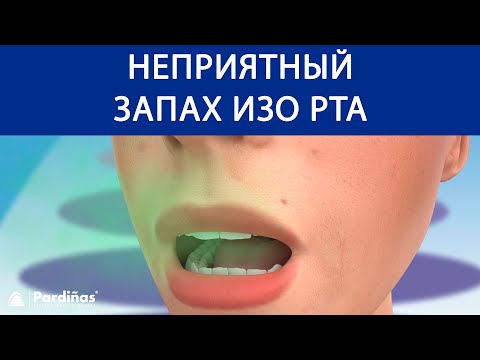 неприятный запах изо рта ©