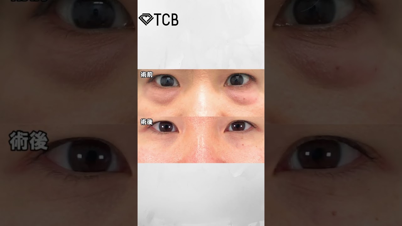 Youtubeのサムネイル