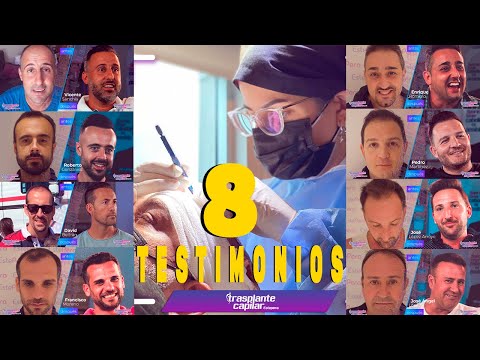 8 testimonios reales de clientes de ESTEPERA tras su trasplante capilar en Turquía