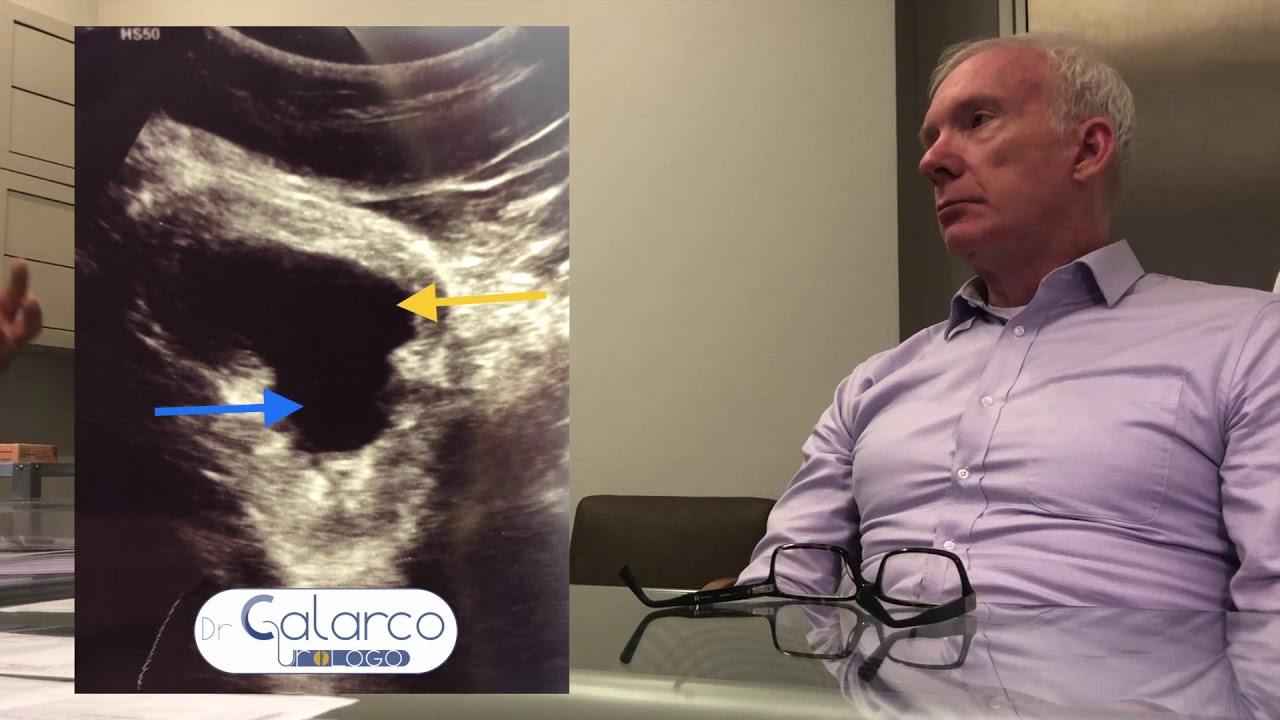 Alessandro Calarco-8