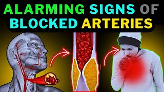 Silent Signs of Artery Blockages You Can’t Ignore 2025 #arteryblockage