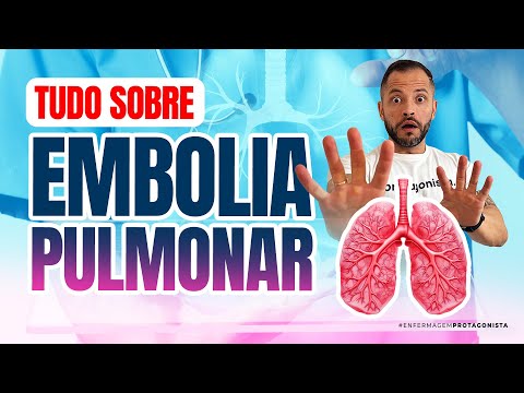 Tudo Sobre Embolia Pulmonar