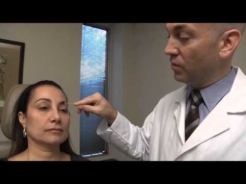 Rosa Uppler Lid Blepharoplasty Entry #2