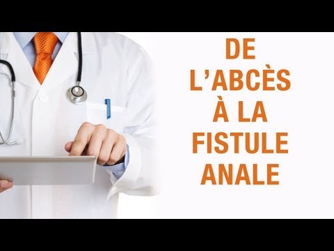 comment guerir abces perianal