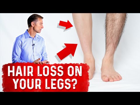 Why PROTEIN Does Not Help Hair Loss Brittle Nails and Collagen Loss – Dr Berg