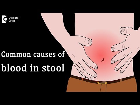 pinworms károsítja a testet