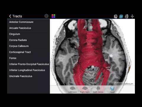 Brain Tutor 3D