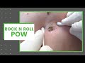 Rock N Roll POW | Dr. Derm