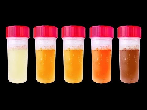 16 неделя беременности спина сильно болит Нервные болезни остеохондроз